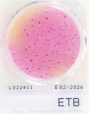 ETB